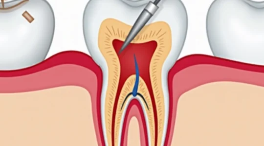 ulcer-after-tooth-extraction-causes-and-care