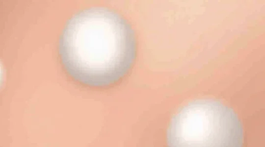white-marks-on-testicles-what-they-may-indicate
